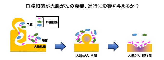 マイクロバイオームグループは口腔と大腸の細菌叢の解析を実施中
