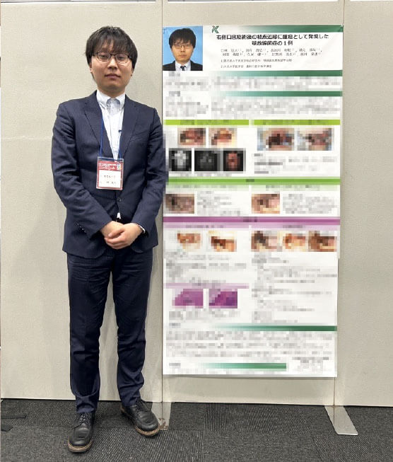 若手口腔外科医交流会第4回学術集会を終えて画像